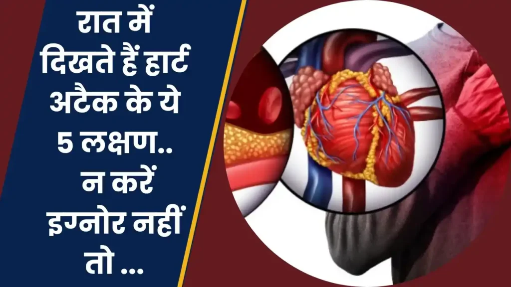 heart attack