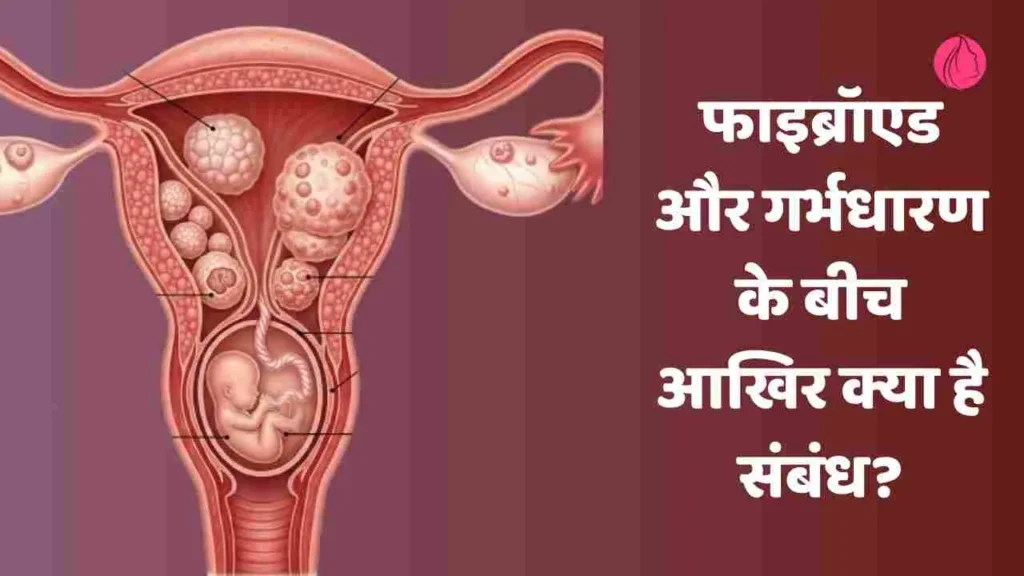 pregnancy and fibroid